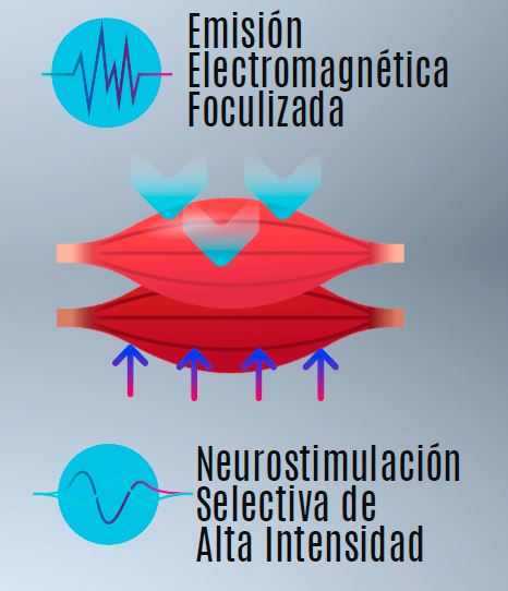 Emisión electromagnética y Neuroestimulación selectiva